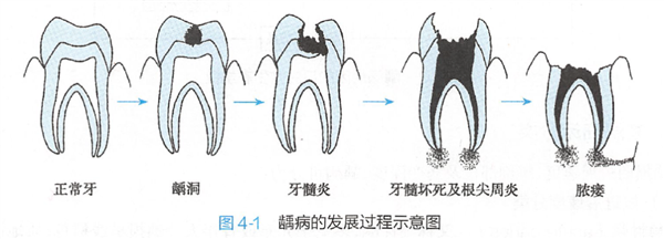 给曹操一盒布洛芬 能拯救他的头痛吗
